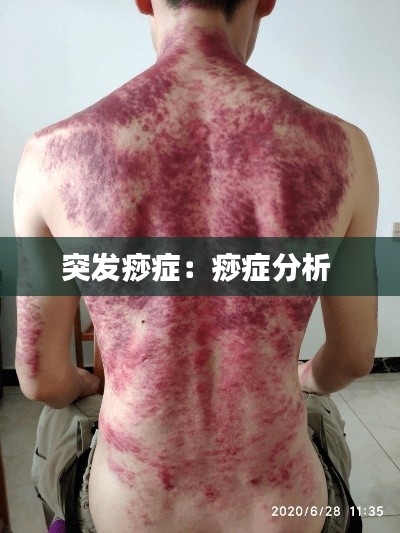 不怕一万，就怕万一 第2页
