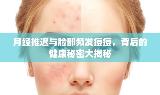 月经推迟与脸部频发痘痘，背后的健康秘密大揭秘