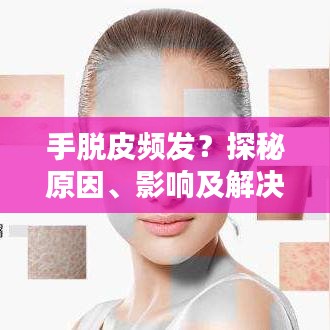 手脱皮频发？探秘原因、影响及解决策略！