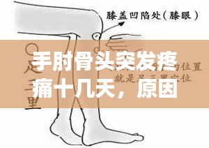 手肘骨头突发疼痛十几天，原因解析、诊断及治疗方法指南
